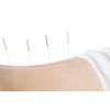 Okanagan-Similkameen Community Acupuncture