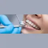 Smile Design Ottawa