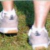 Lakewood Foot Clinic