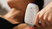 Laser Hair Removal