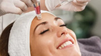 Microneedling